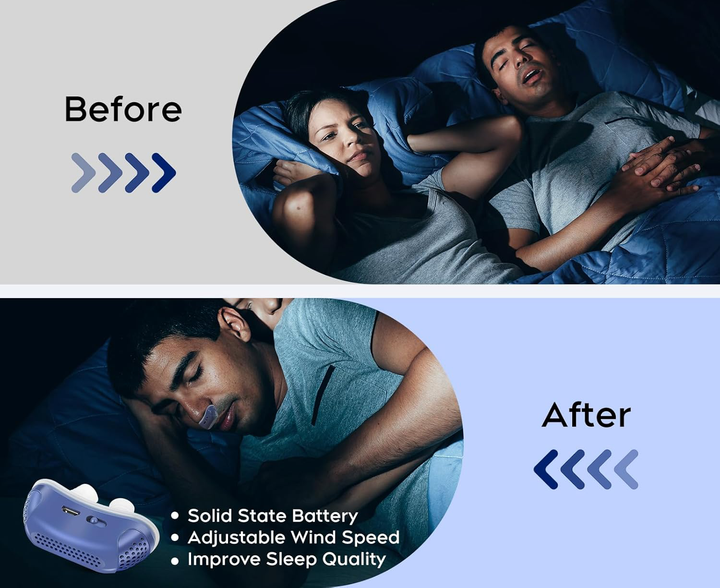Colverro™ Mask-Free Anti-Snoring Nasal Device for Quieter Sleep