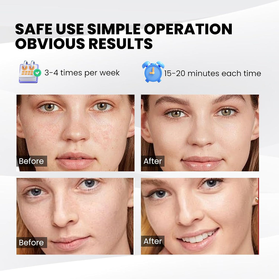 Colverro™ LED Face Mask with 7 Light Colors and Remote Control