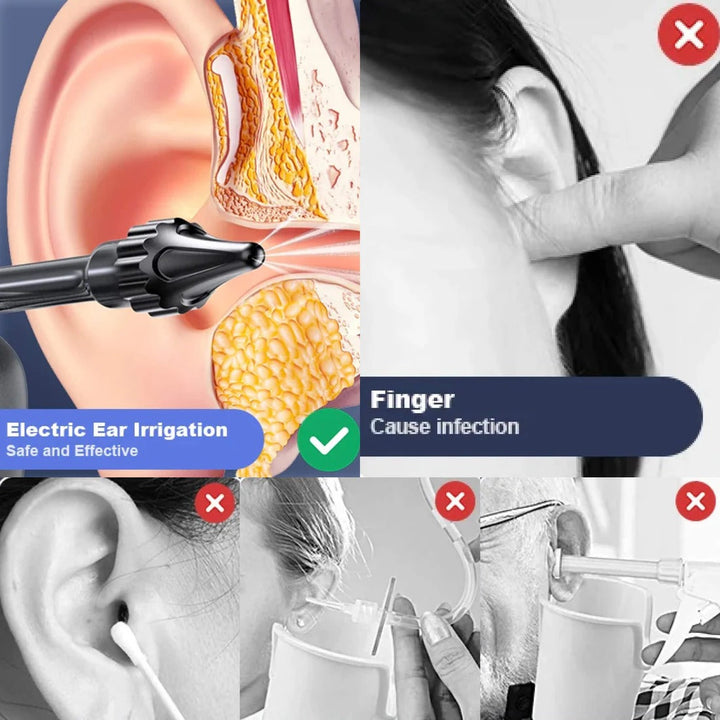 Colverro™ Rechargeable Ear Cleaning Irrigation Tool with 3 Pressure Settings